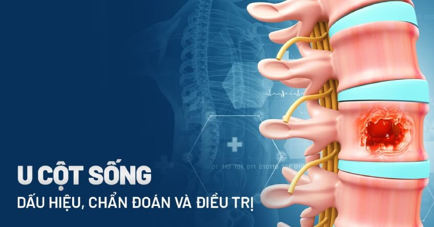 Chăm sóc sức khỏe tâm lý và tinh thần cho bệnh nhân hiểm nghèo