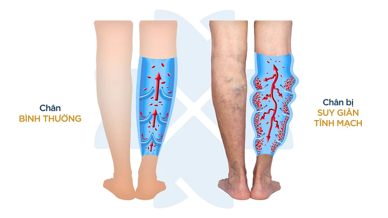 Đại hội Giới trẻ Giáo tỉnh Sài Gòn: Sống tinh thần hiệp hành